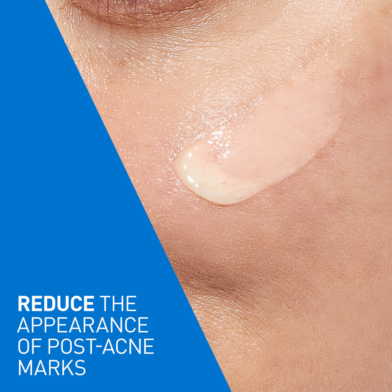 CeraVe Blemish Resurfacing Retinol Serum 30ml