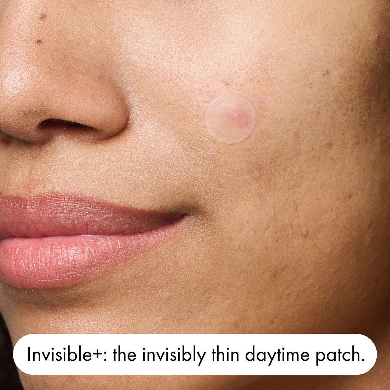 Hero Mighty Patch Duo Pimple Patches | Day & Night Patches | 12 pack