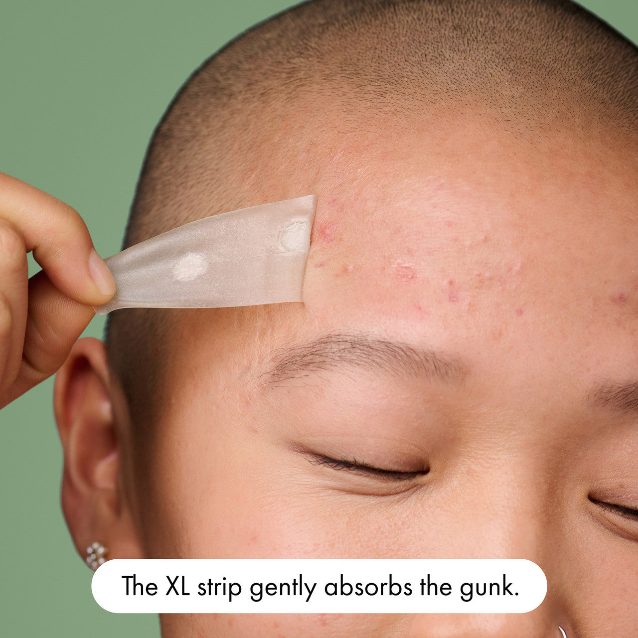 Hero Mighty Patch Surface Pimple Patches | Face Body & Back | XL-Sized | 10 pack