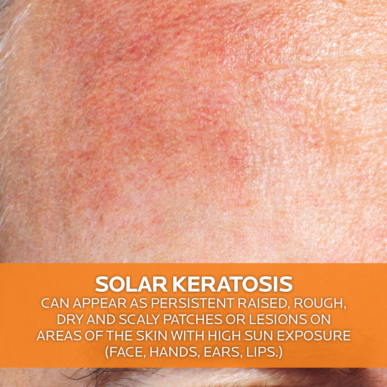 Anthelios KA+ SPF50+ 50ml