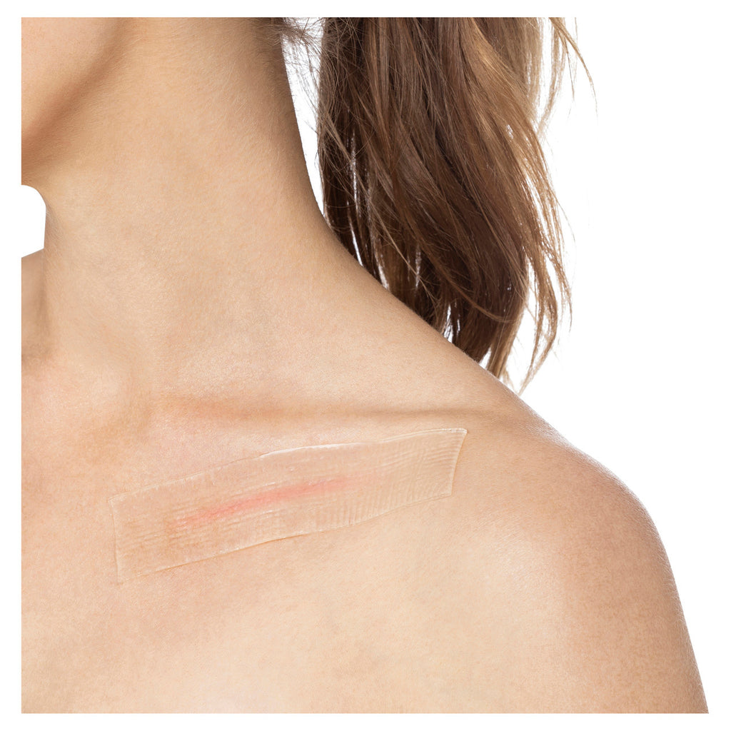 CICA-CARE 3CM X 12CM