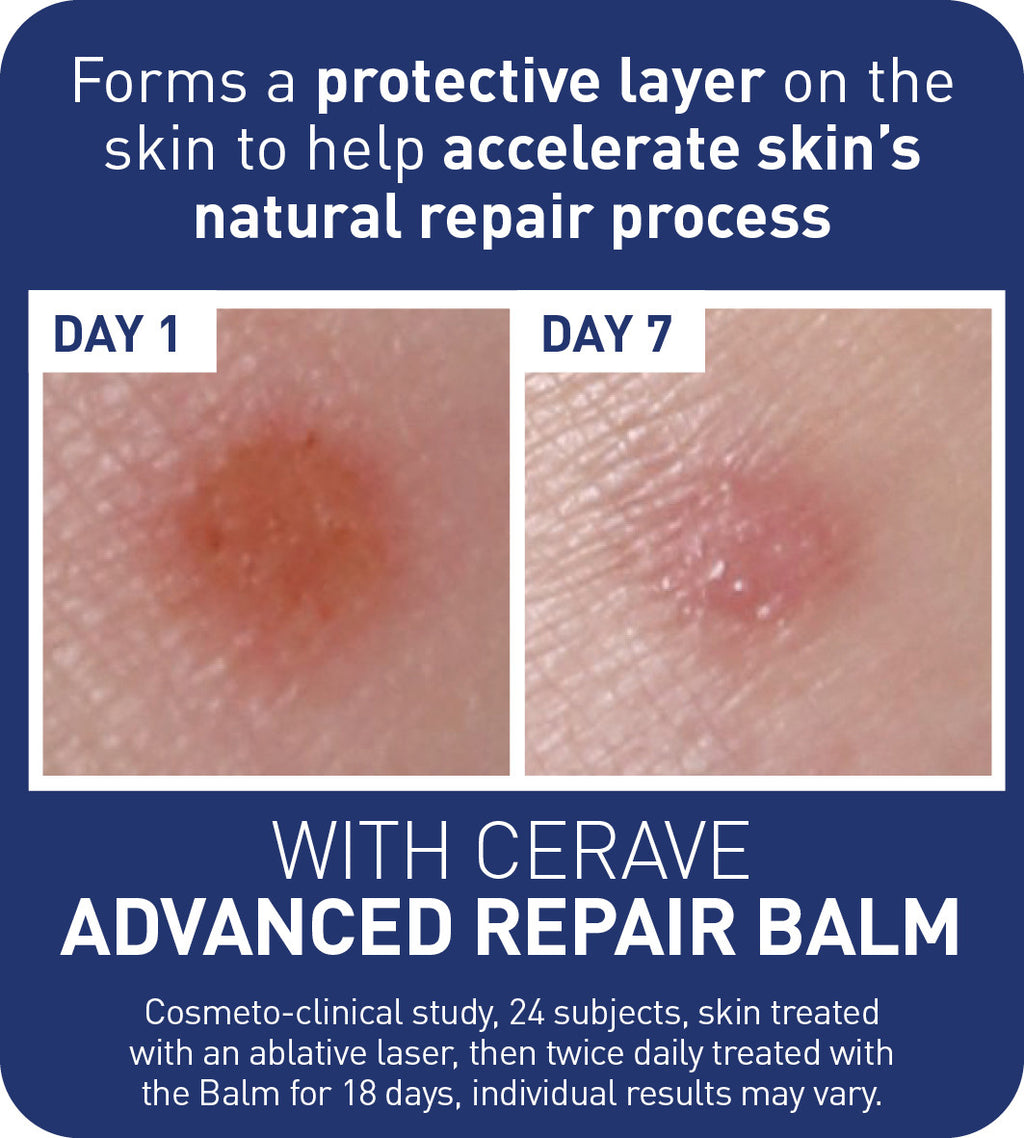 CeraVe Advanced Repair Balm 50ml