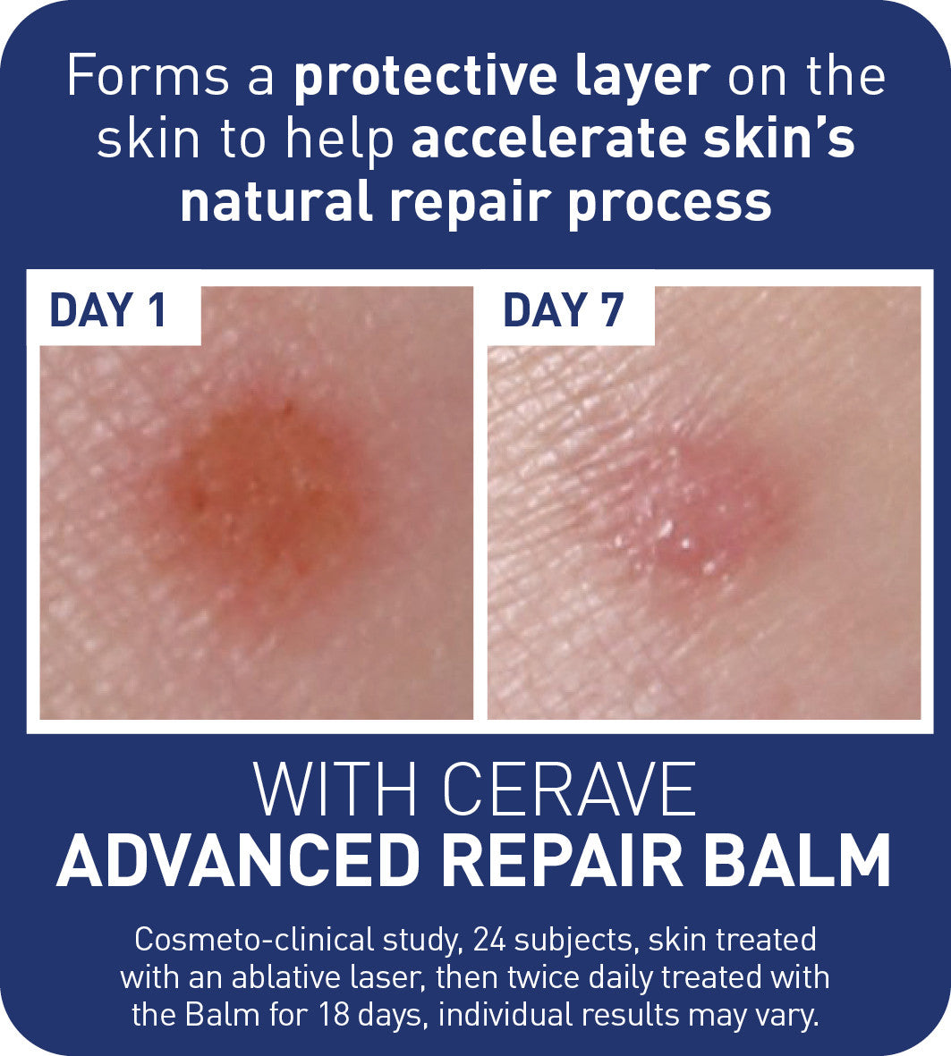 CeraVe Advanced Repair Balm 50ml