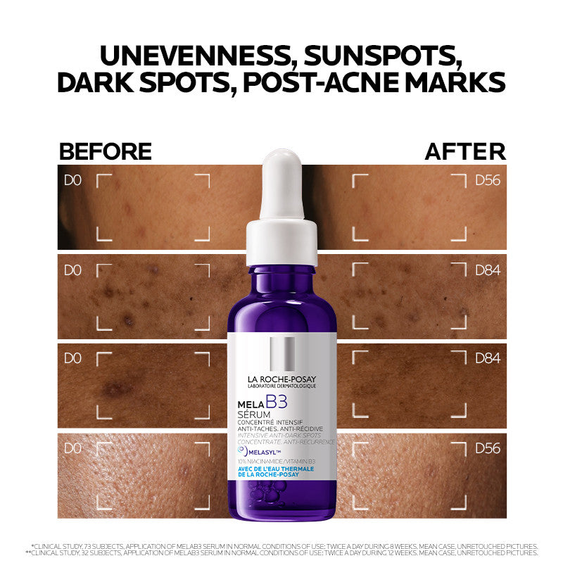 La Roche-Posay Mela B3 Niacinamide Dark Spot Serum