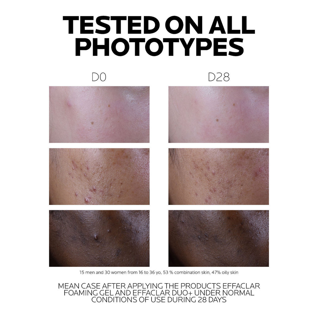 La Roche Posay Effaclar Duo+ M Moisturiser 40ml