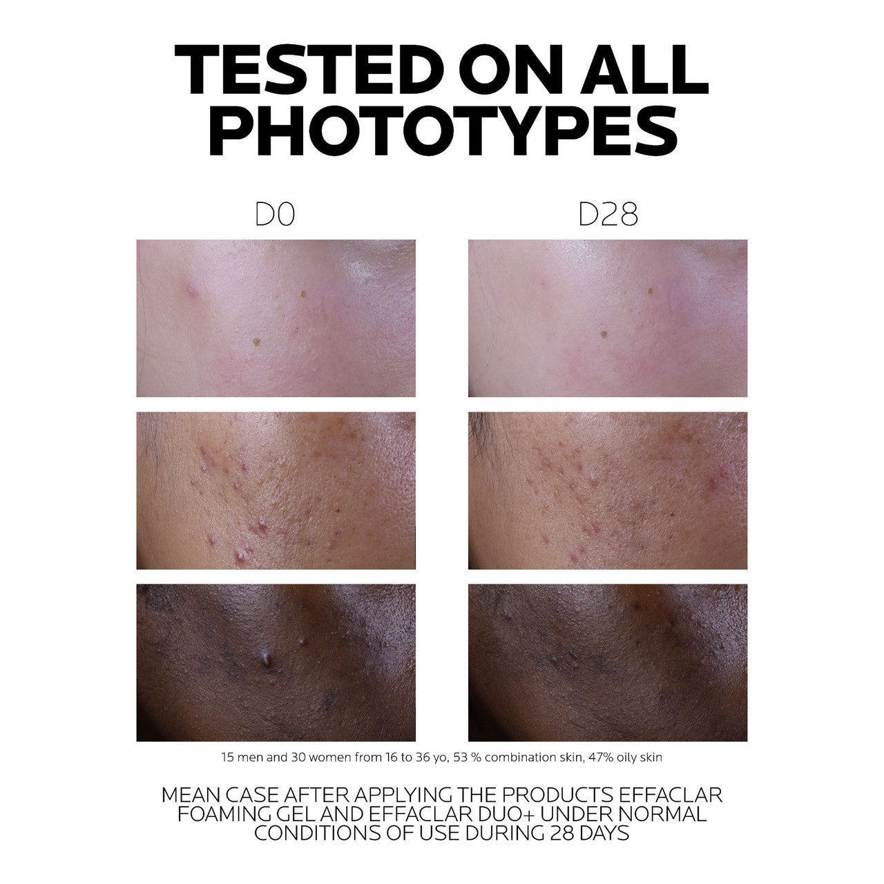 La Roche Posay Effaclar Duo+ M Moisturiser 40ml