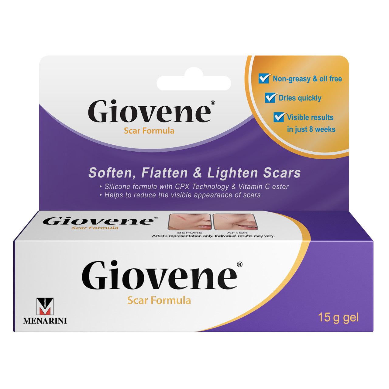 Giovene Specialised Scar Formula 15g Gel