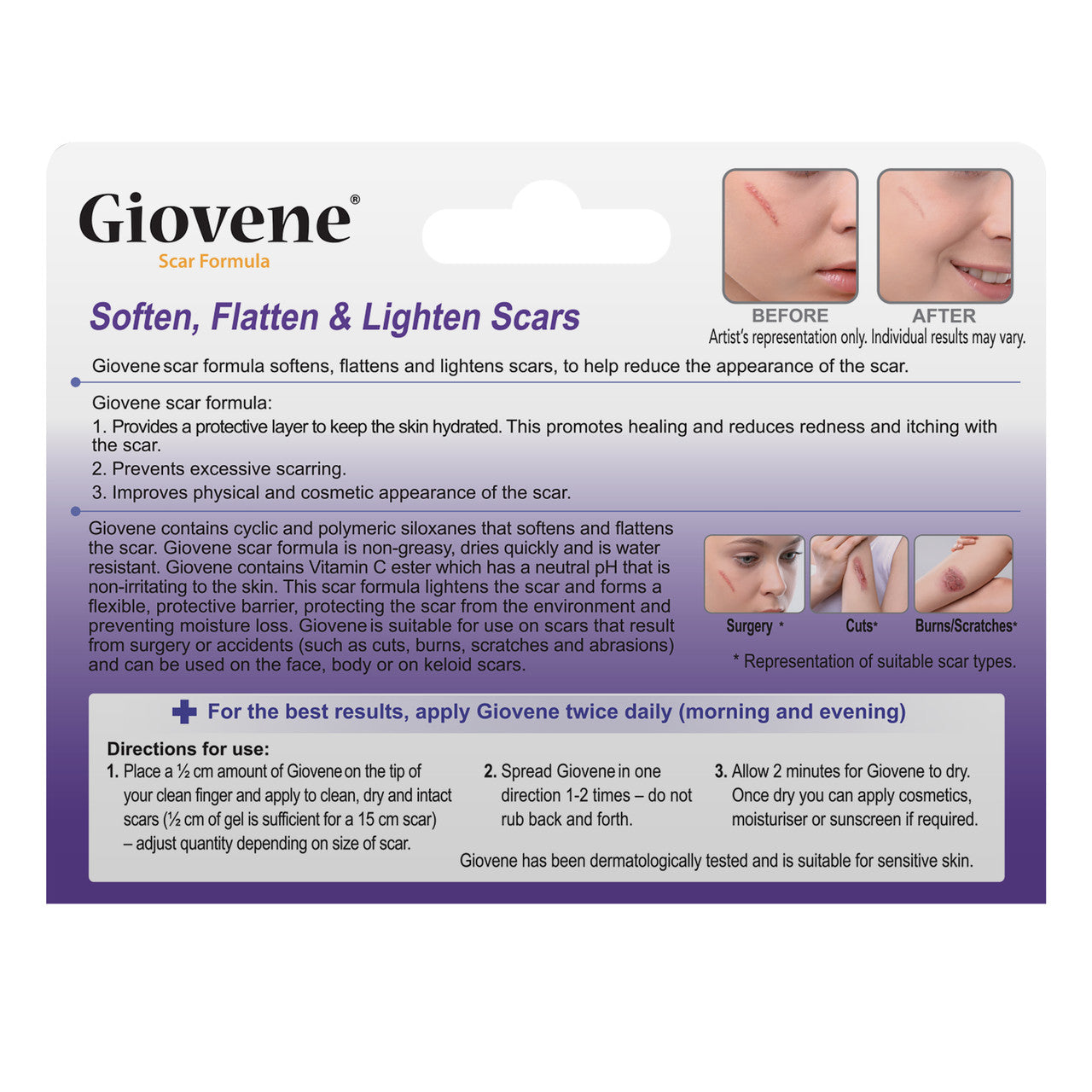 Giovene Specialised Scar Formula 15g Gel