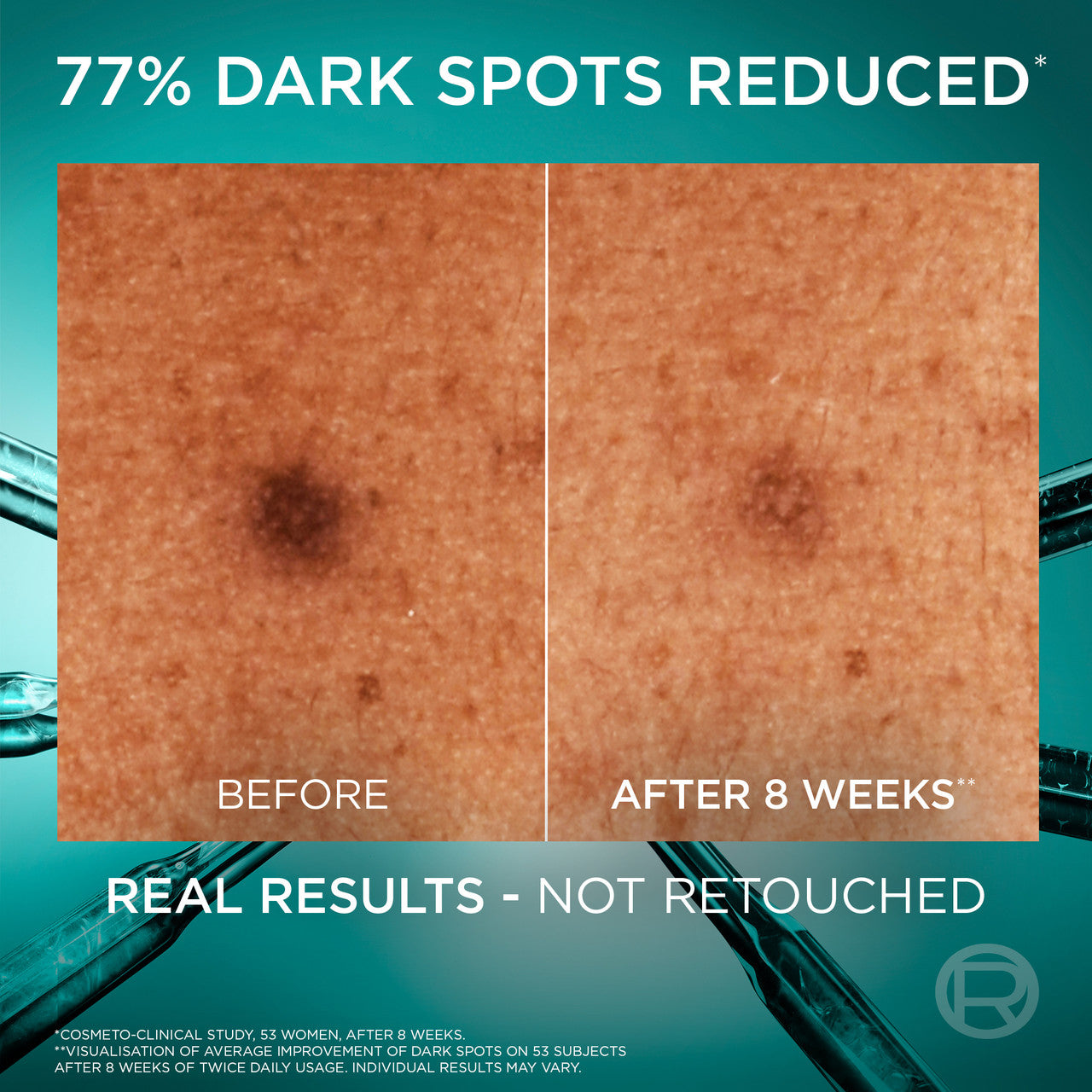 L'Oréal Paris Bright Reveal 10% [Niacinamide + Melasyl + Amino-Sulfonic Acid] Dark Spot Face Serum 30ml 