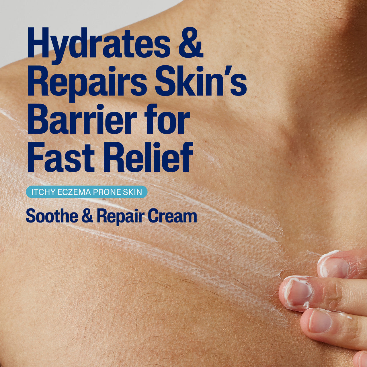 Cetaphil Pro Eczema Prone Soothe & Repair Cream