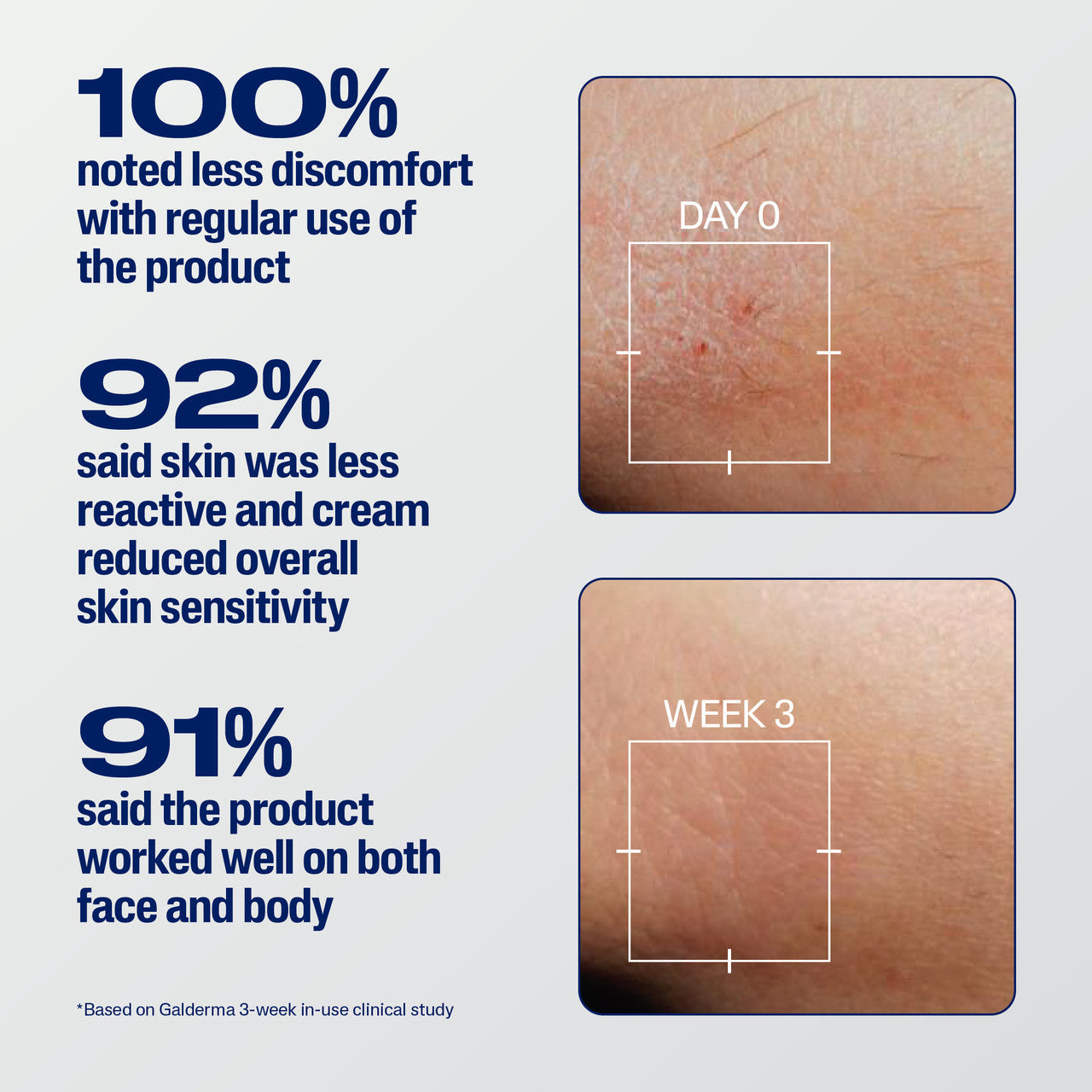 Cetaphil Pro Eczema Prone Soothe & Repair Cream