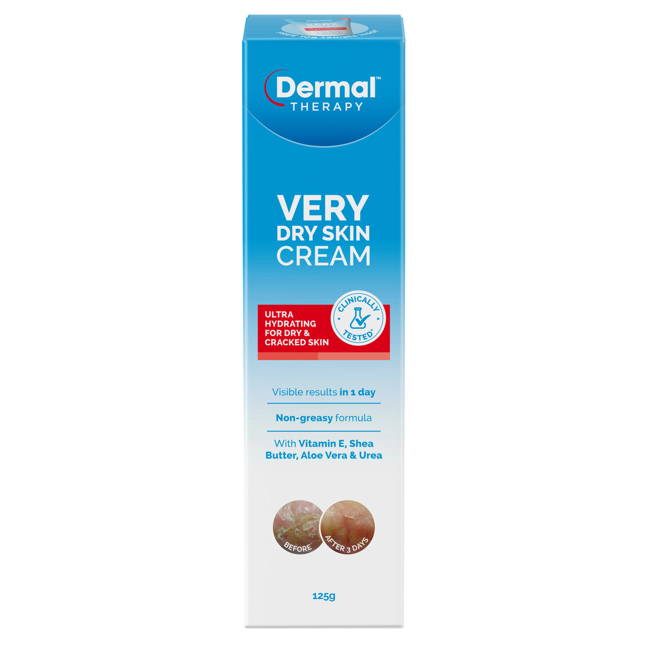 Dermal Therapy Very Dry Skin Cream 125g