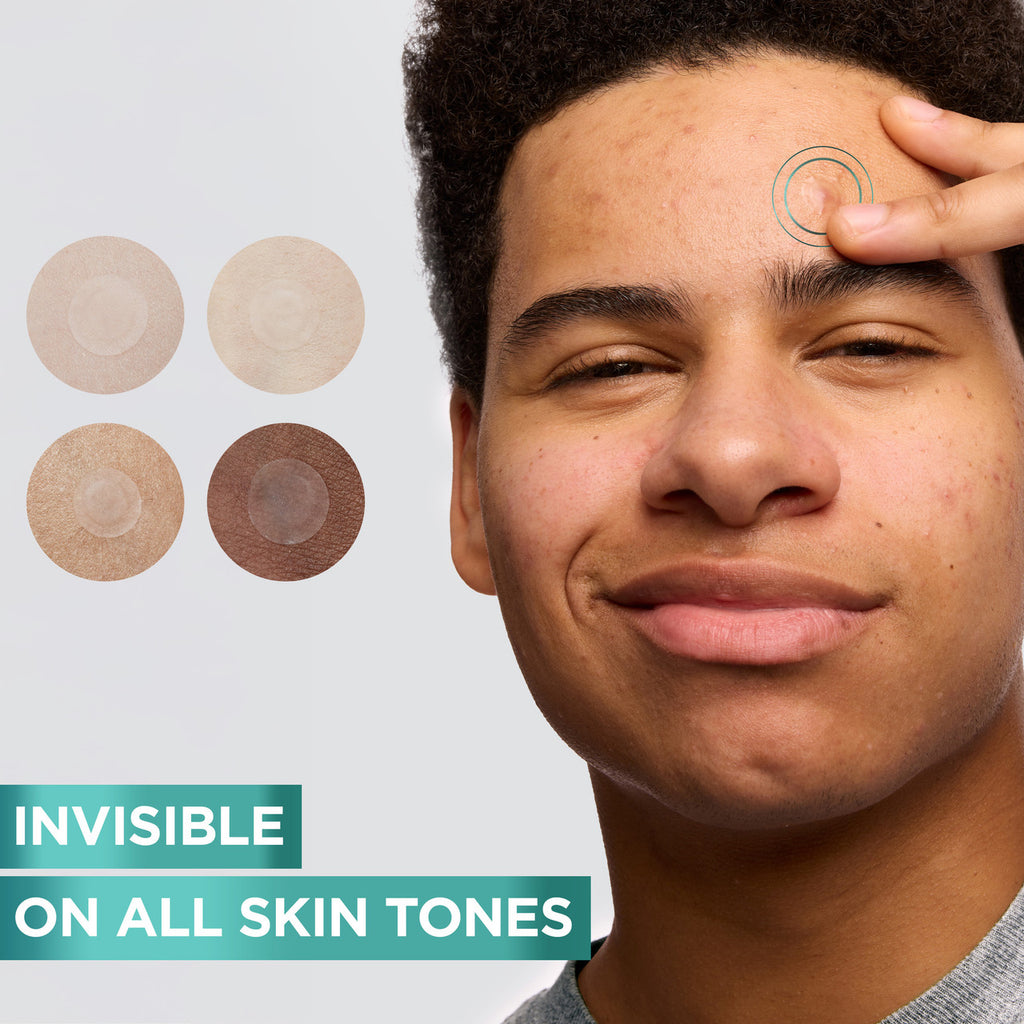 Garnier Pure Active 8hr Pimple Patch 22pk