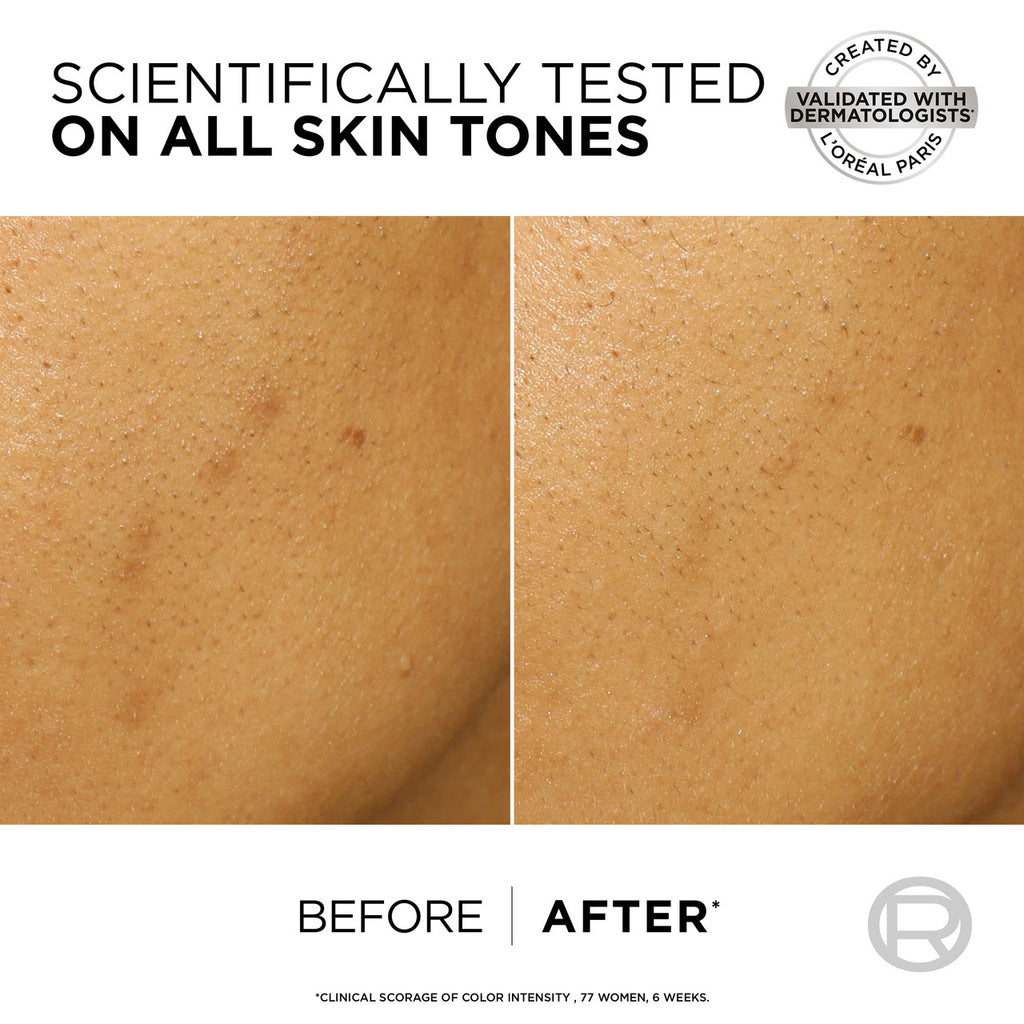 L'Oréal Paris Bright Reveal 25% [AHA + BHA + PHA] + Niacinamide Dark Spot Exfoliant Peel 25ml