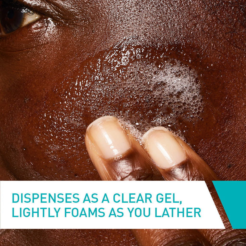 CeraVe Salicylic Acid Blemish Control Cleanser 236ml for Mild Acne-Prone Skin