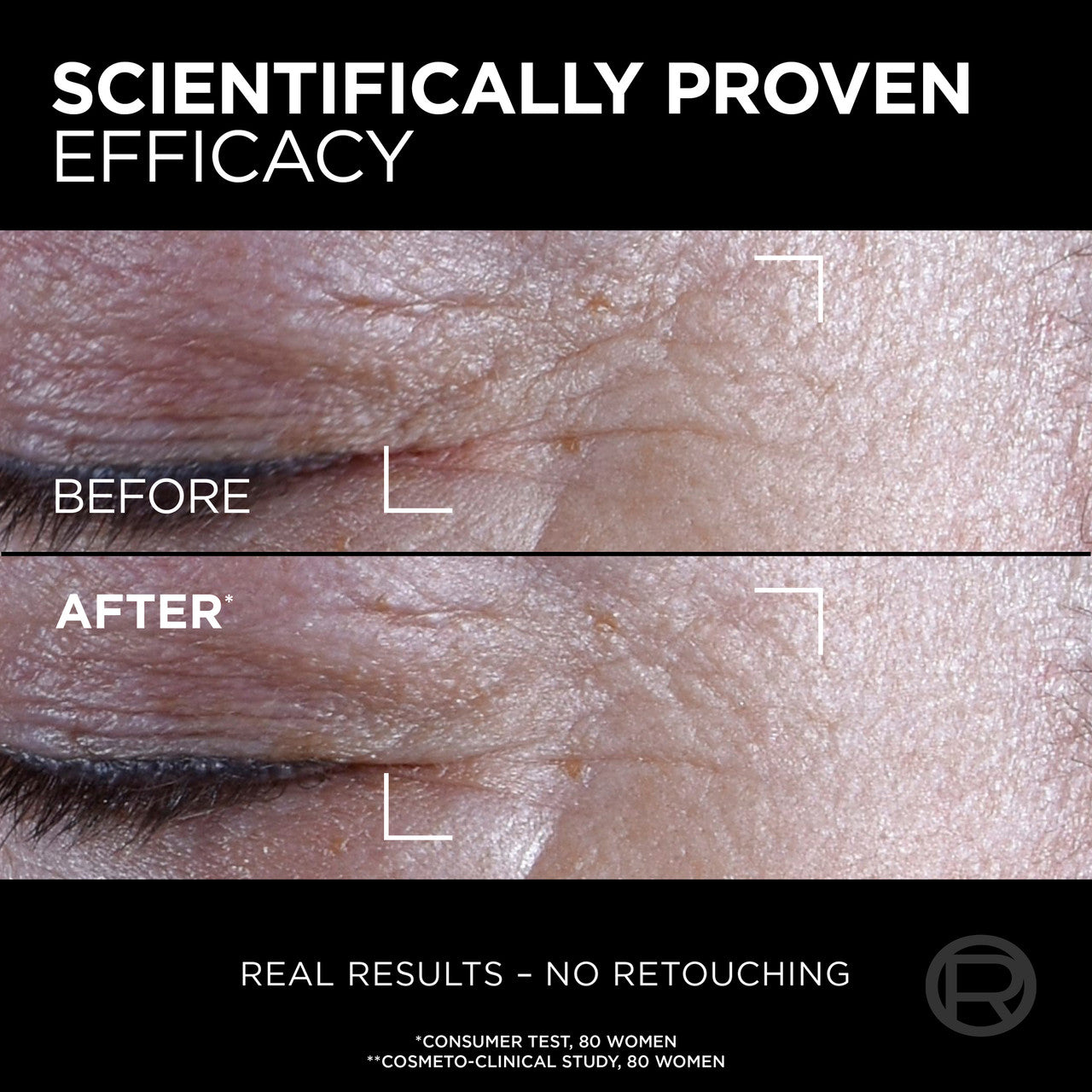 L'Oréal Paris Age Perfect Cell Renewal Midnight Eye Opener Cream 15ml