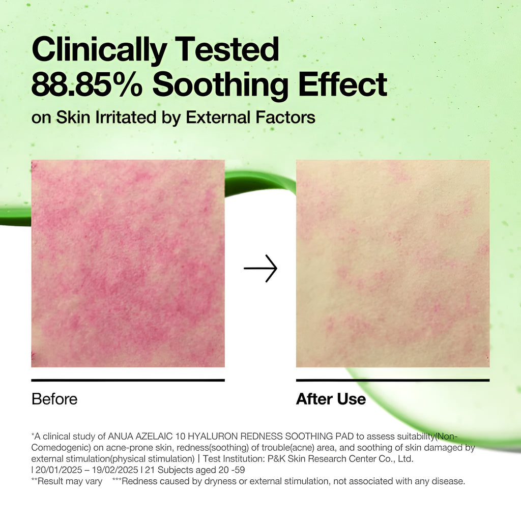 Anua Azelaic 10 Hyaluron Redness Soothing Pad 70 Pack